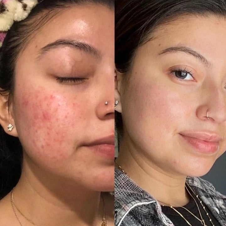 Kojic Acid & Turmeric Soap